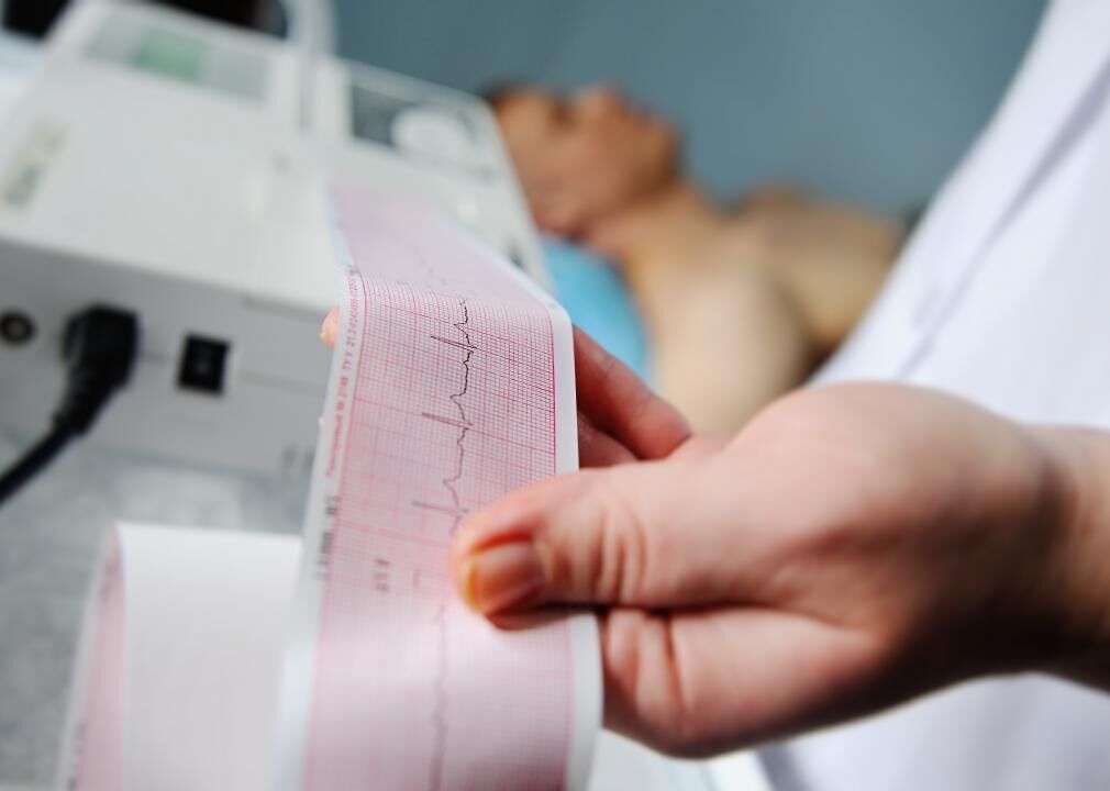 #21. Echocardiography